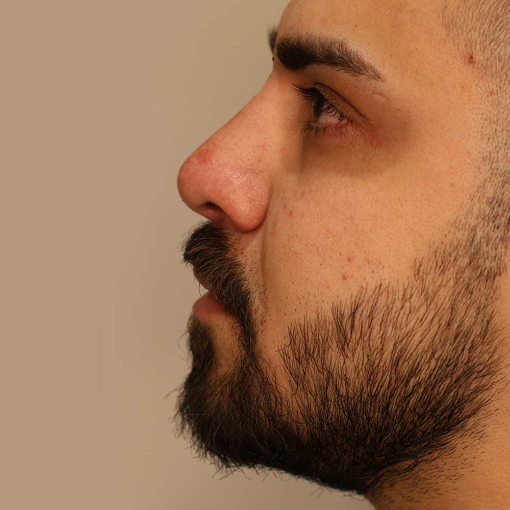 بعد